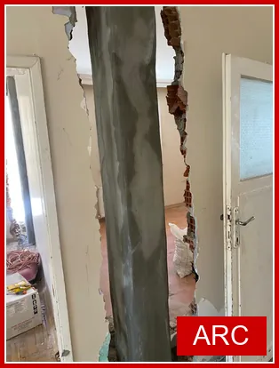 Kolon Güçlendirme Rehberi: Hangi Yöntem Daha Güvenli?